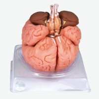 康谊牌KAY-A611高级脑及脑动脉模型-脑解剖模型