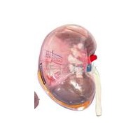 KAY-L1156透明肾脏放大模型-肾模型-人体解剖教学模型